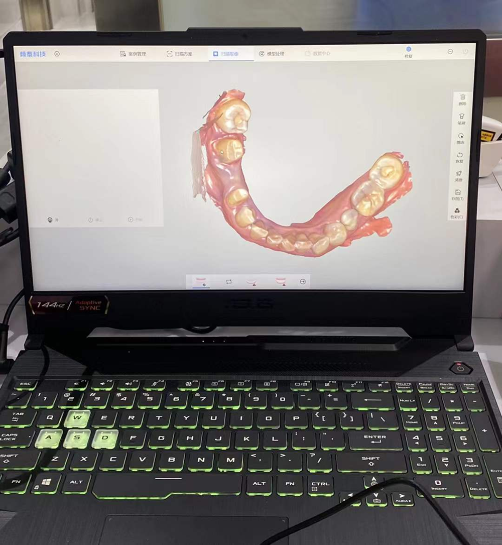 5bbd78861a054d449e9202046e8f3b64.png 5bbd78861a054d449e9202046e8f3b64.png